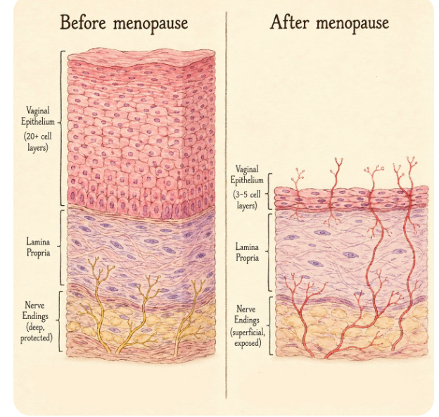 The Sandpaper Feeling Disappears In 3-5 Weeks