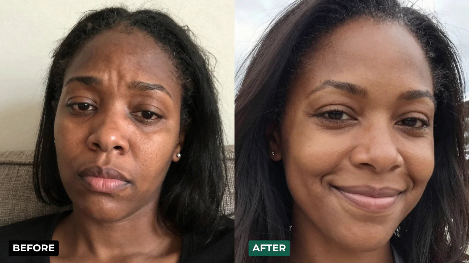 Before after woman