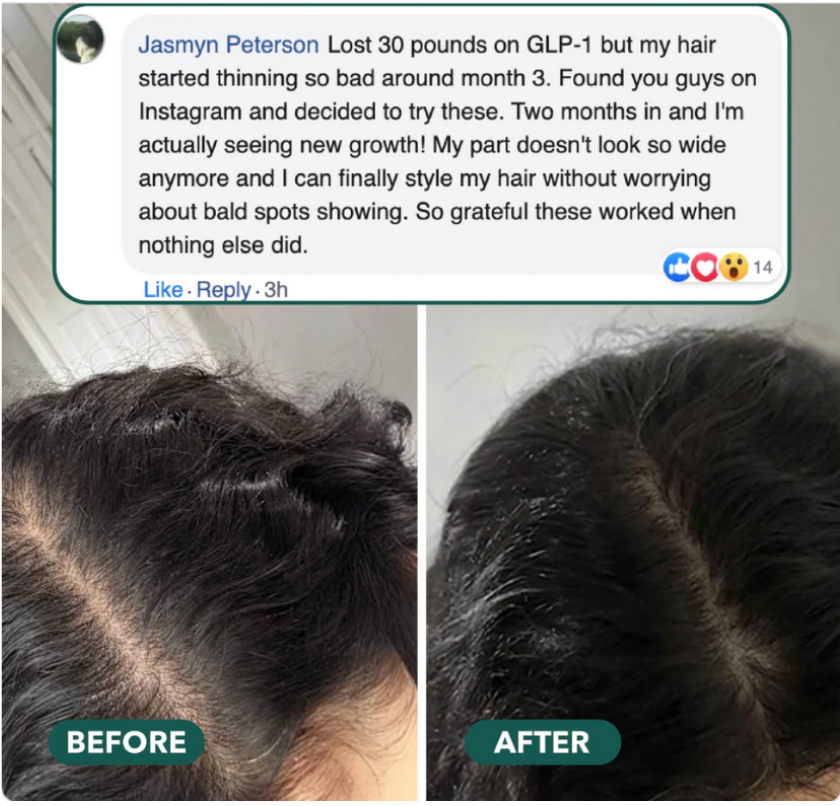 Hair Growth Revitalize Gummies
