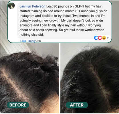Hair Growth Revitalize Gummies