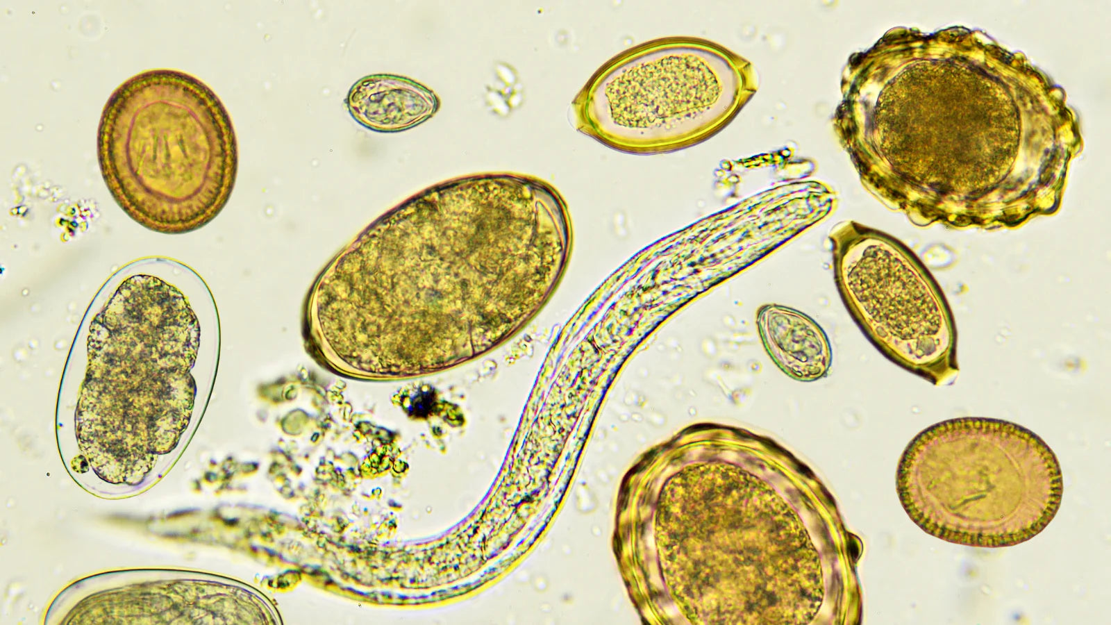 Parasite microscope