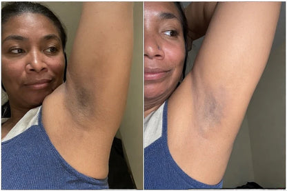 Underarm Brightening Cream